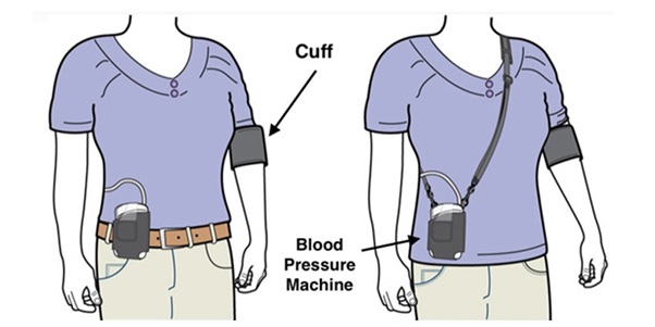 24 hours blood pressure monitor